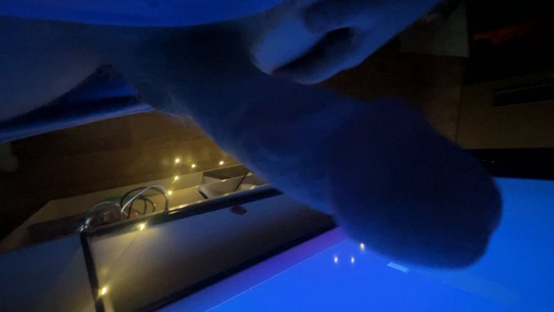 treatment anal fissure — GRECIA Nude Leaked OnlyFans Photo - 1:47:22
