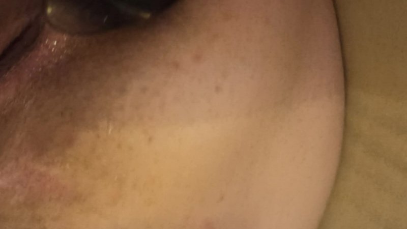 anal eczema with Michelle Kushel — anal tube video