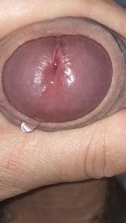 adult in recovery tonsillectomy ft. Emiliya Ocean — free porn video (17:30)